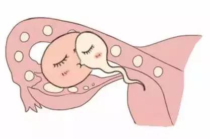 正规同性代孕咨询包生儿子